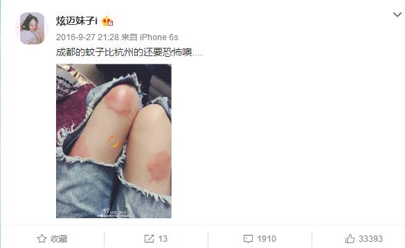 快手网红孙晨炫迈拍摄视频秀恩爱 不了裤子上的大洞引发关注